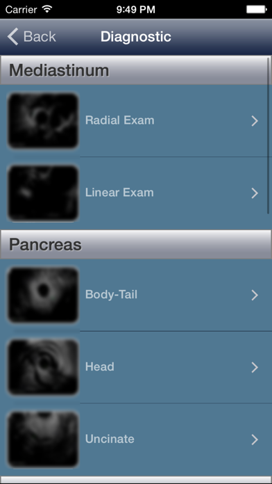 How to cancel & delete EUS - Diagnostic and Interventional Endoscopic Ultrasound from iphone & ipad 2