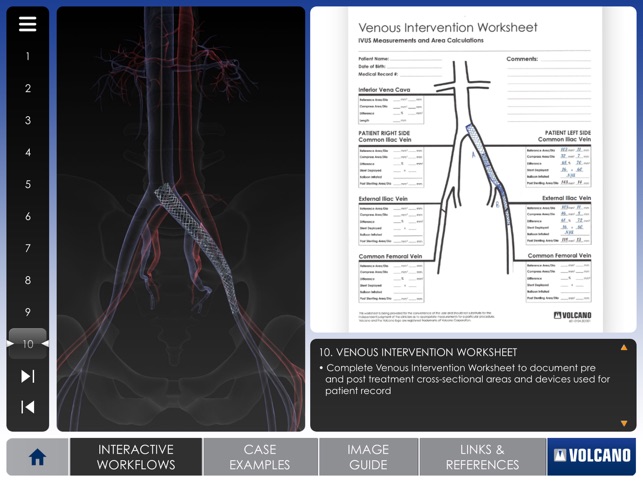 Venous IVUS(圖4)-速報App