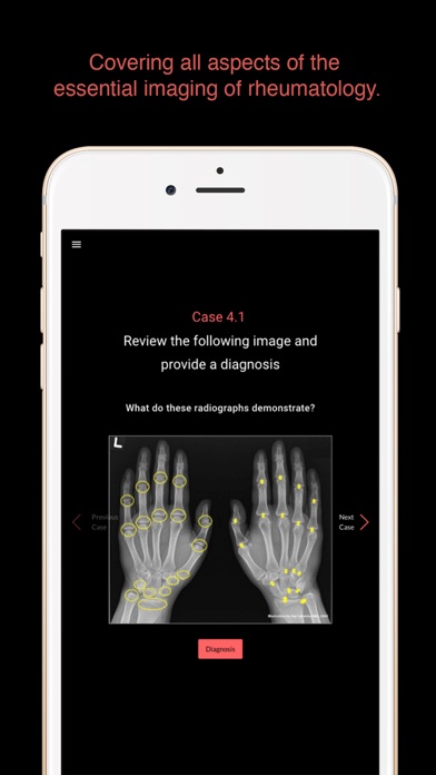 How to cancel & delete ESIMR: Clinical Case Challenge from iphone & ipad 2