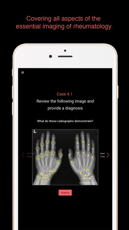 ESIMR: Clinical Case Challenge