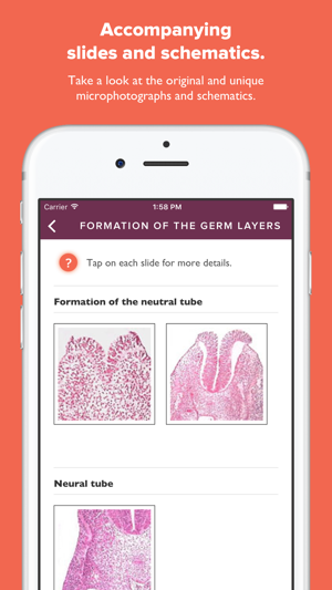 Atlas of Human Embryology(圖2)-速報App