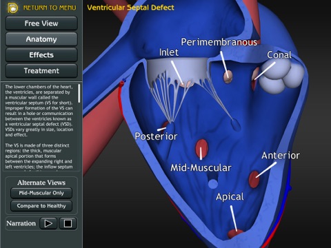 3D Road Map to ASD & VSD screenshot 3