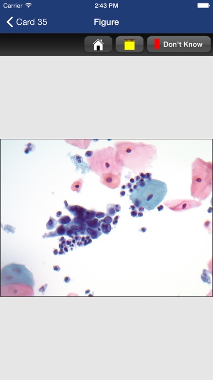 McGraw-Hill Specialty Board Review Anatomic Pathology Flashcards screenshot-4