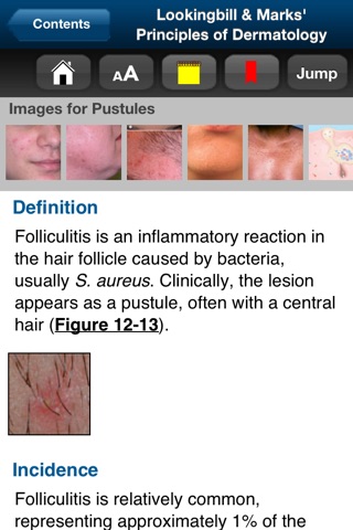 Lookingbill & Marks' Derm. 5E screenshot 4