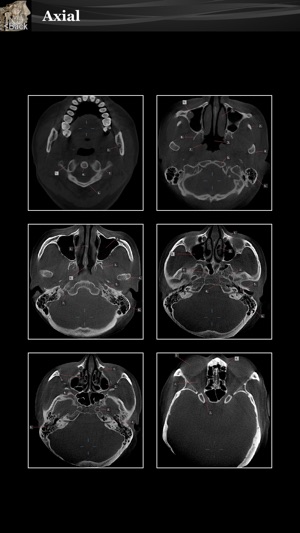 Scanatomy(圖2)-速報App