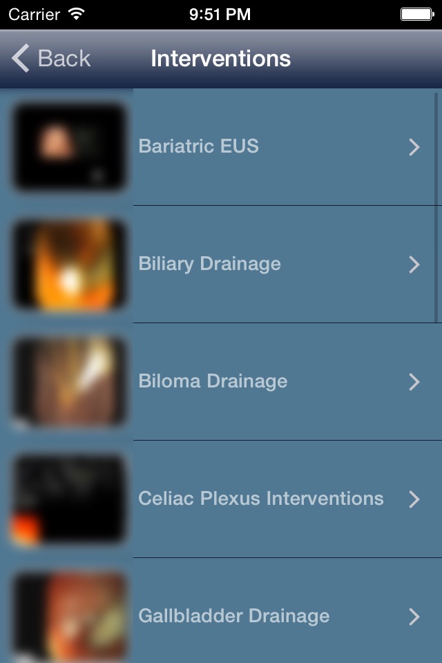 EUS - Diagnostic and Interventional Endoscopic Ultrasound screenshot 3