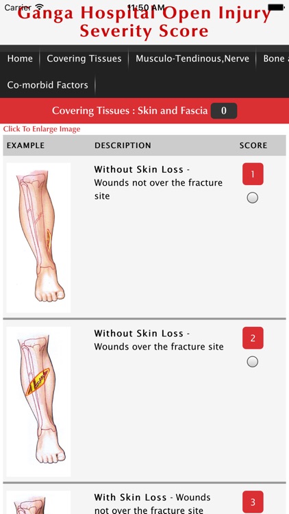 Ganga Hospital Score