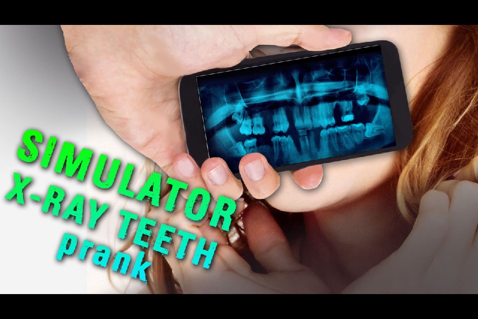 Simulator X-ray Teeth Prank screenshot 3
