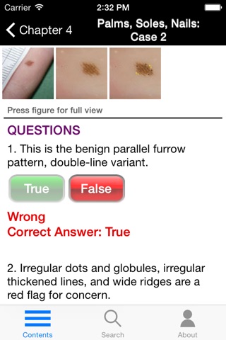 Dermoscopy: An Illustrated Self-Assessment Guide screenshot 3