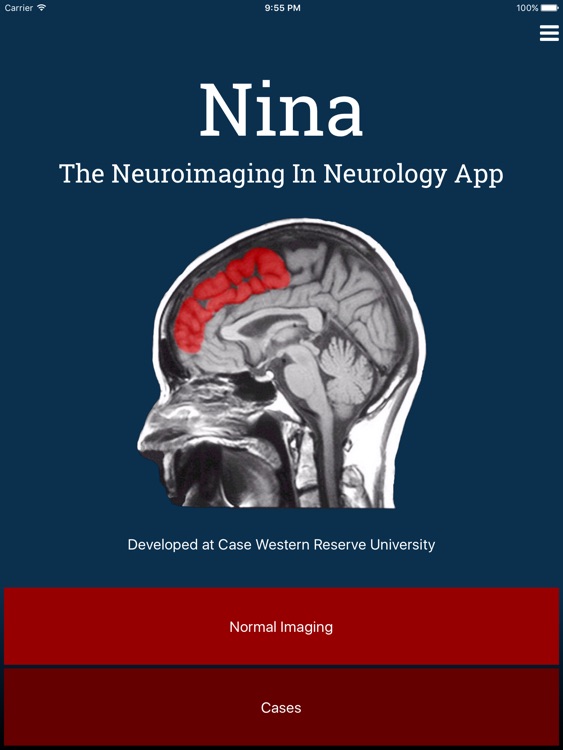 Nina Neuroimaging in Neurology