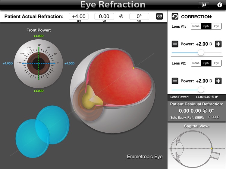 Eye Refraction