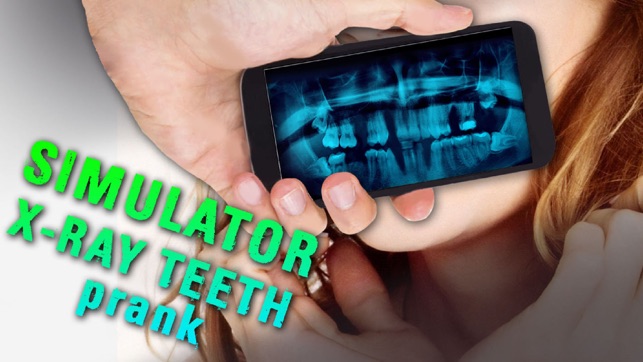 Simulator X-ray Teeth Prank(圖3)-速報App