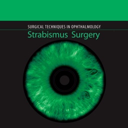 Strabismus Surgery