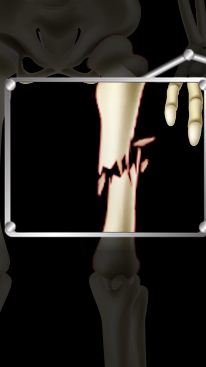 Ambulance Doctor – Free surgery game, Doctor games for kids, teens and girls, Hospital and clinical fun games screenshot-4