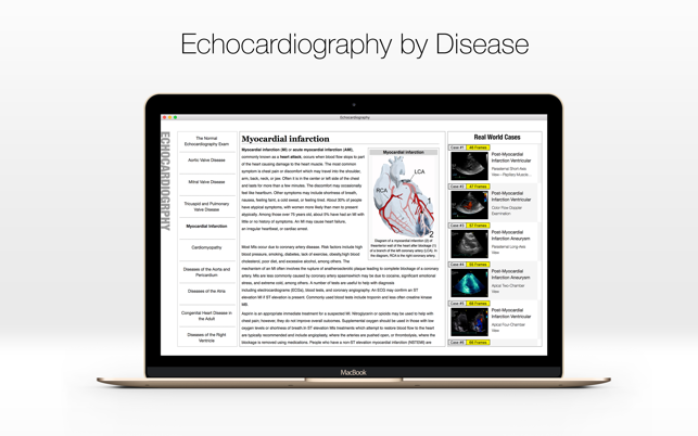 Echocardiography - Case Study and Review(圖3)-速報App