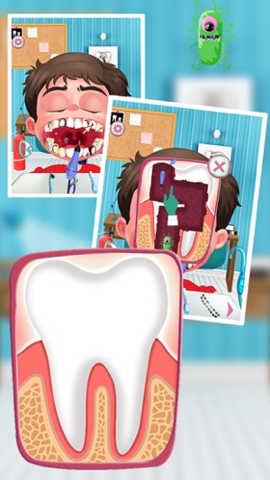 Dentist Cleanup Teeth(圖2)-速報App