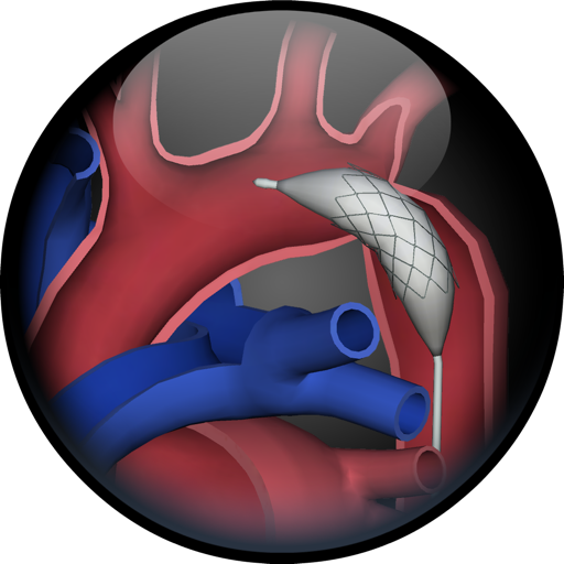 3D Road Map to Congenital Heart Disease