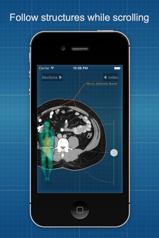X-Anatomy Pro screenshot 3