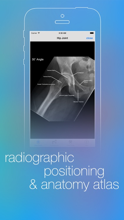 iRad Xrays screenshot-3