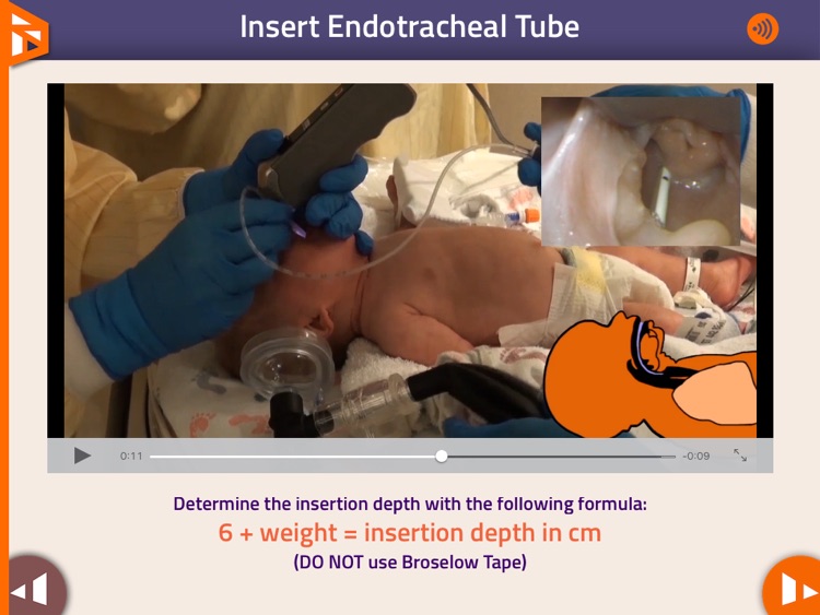 Neonatal Airway screenshot-4