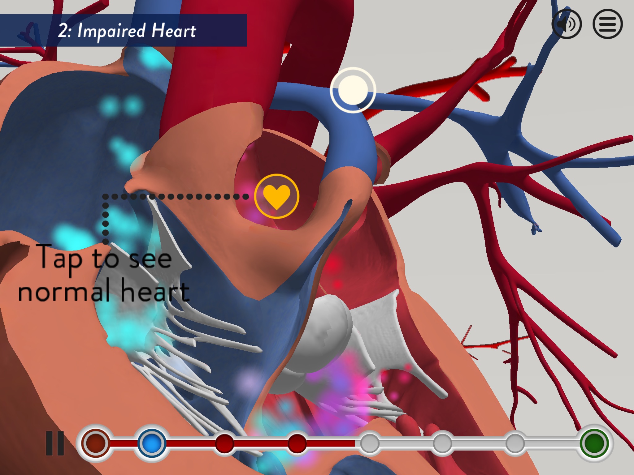 Child Heart Surgery screenshot 4