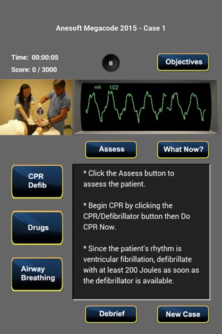 ACLS Megacode Practice 2015 screenshot 2