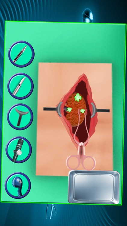 Kidney Surgery – Crazy surgeon & doctor hospital game for kids screenshot-3