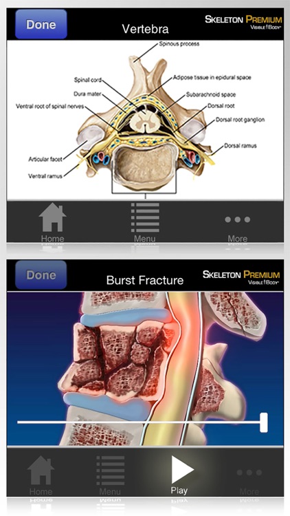 Skeleton Premium for Springer (Skelet Premie voor Springer)