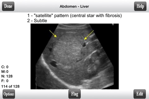 ARRT Sonography (Ultrasound) Flashcards screenshot 2