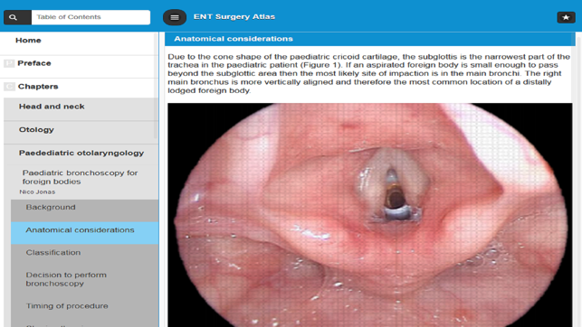 ENT Surgery Atlas(圖3)-速報App