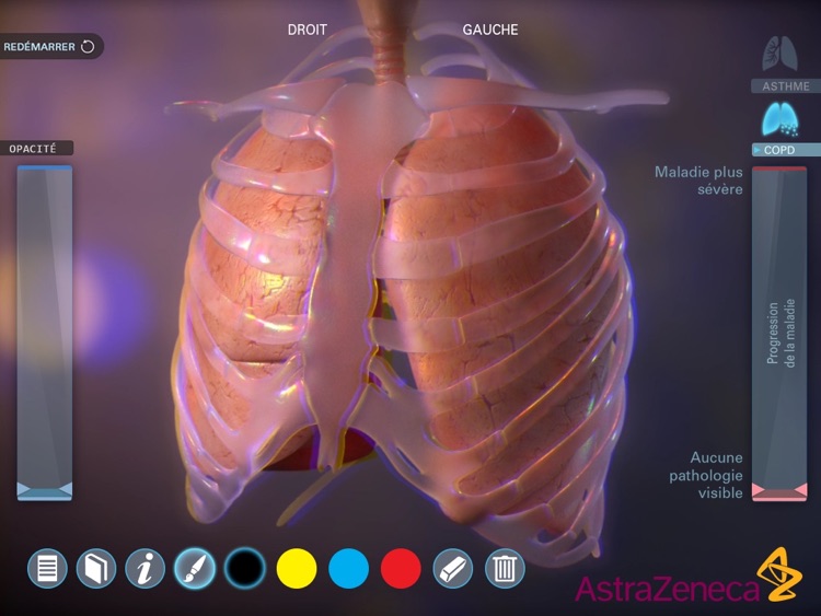 Living Lung screenshot-3