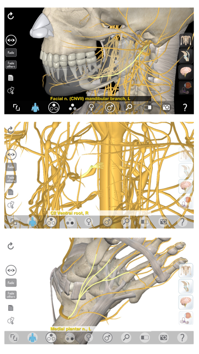 How to cancel & delete 3D Organon Anatomy - Brain and Nervous System from iphone & ipad 3