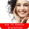 How To Remove Blackheads