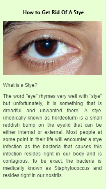How to Get Rid Of A Stye