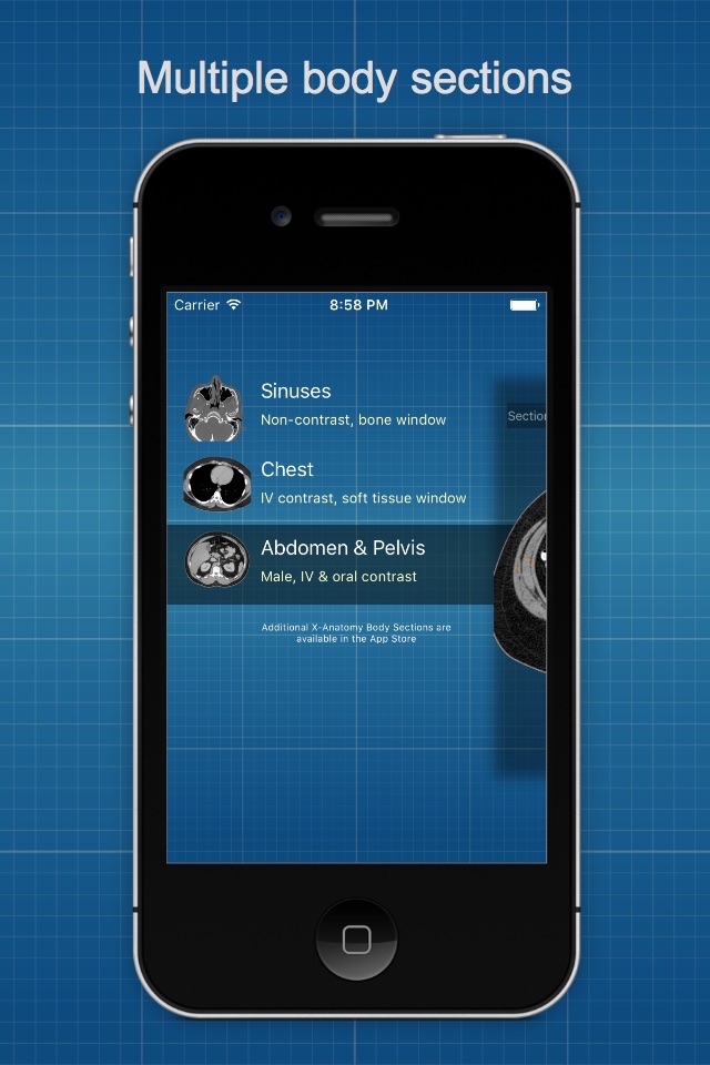 X-Anatomy Basic screenshot 4