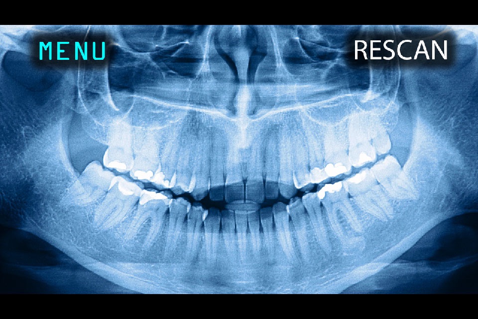 X-Ray Human Teeth Joke screenshot 2