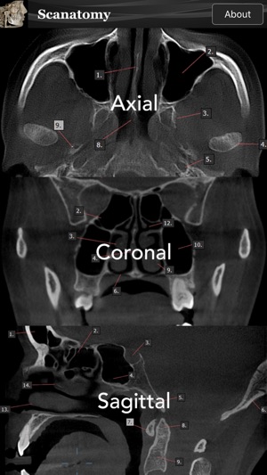 Scanatomy