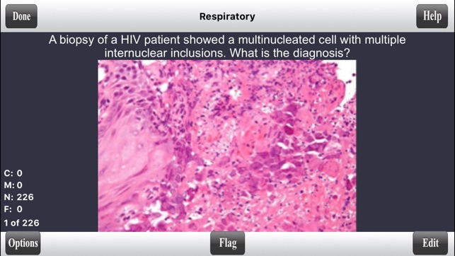 USMLE Step 2 CK Flashcards