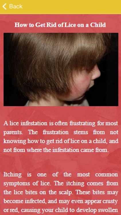 How To Get Rid Of Lice