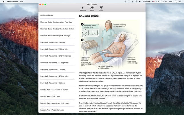 EKG Classes(圖5)-速報App