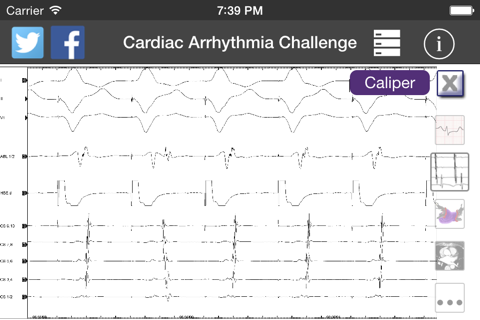 Cardiac Arrhythmia Challenge PRO screenshot 4