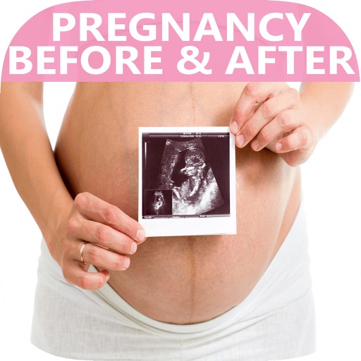 Pregnancy & ChildBirth