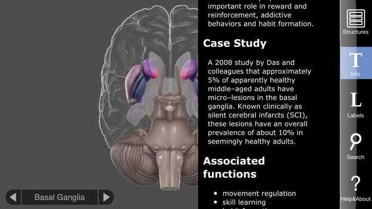 3D Brain