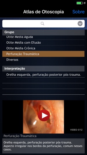 Atlas de Otoscopia(圖2)-速報App