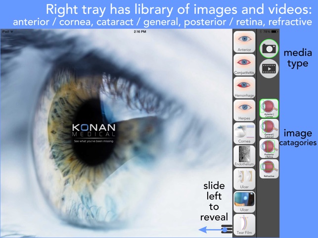 Ophthalmic Media Library(圖2)-速報App