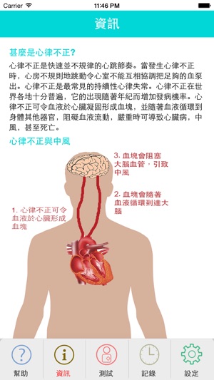 心房顫動檢測器(圖3)-速報App