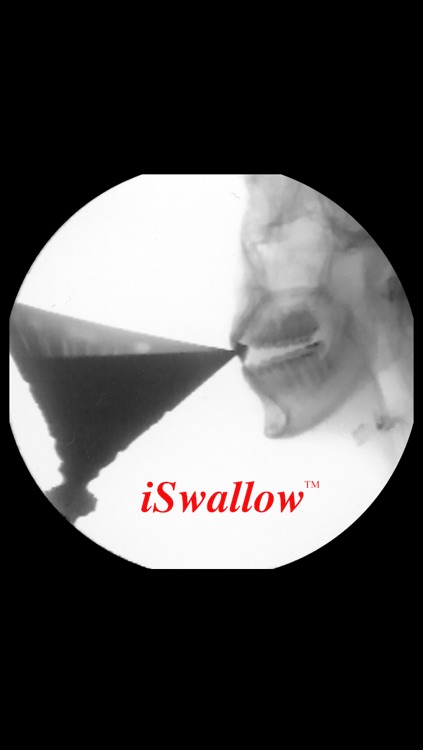 iSwallow screenshot-4