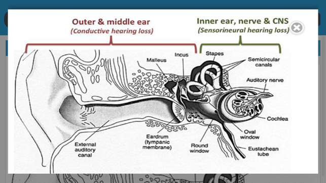 Audiology and Hearing Aids for Otolaryngologist(圖5)-速報App