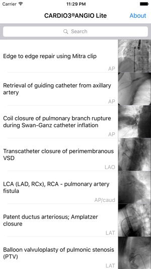 CARDIO3® Atlas of Interventional Cardiology – Lite(圖2)-速報App