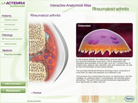 Rheumatoid Arthritis Atlas screenshot 2